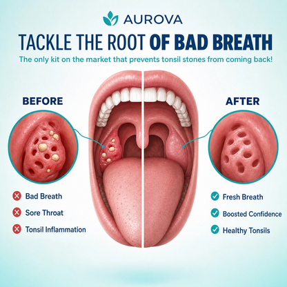 Aurova Pro™ | HD Visual Tonsil Stone Remover