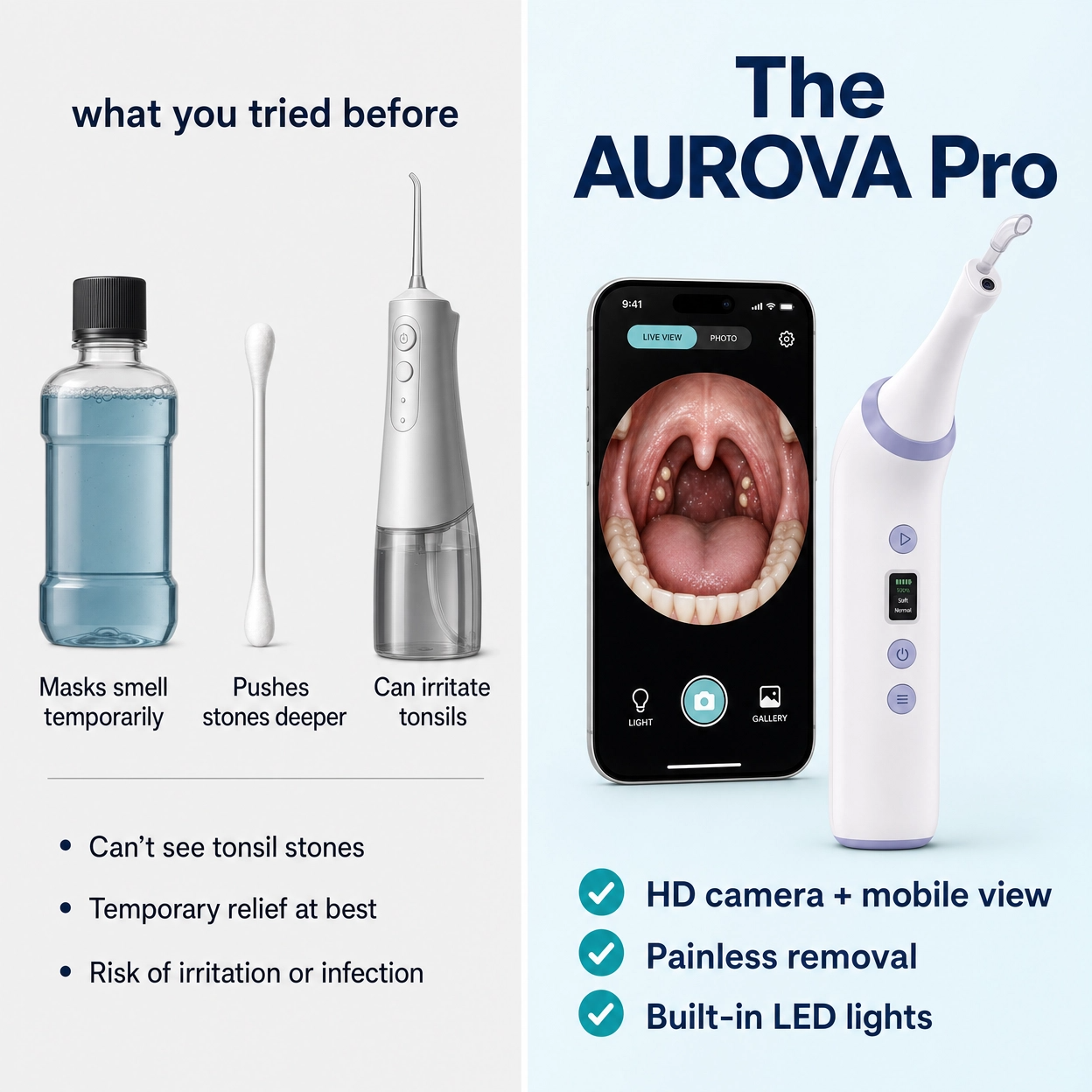 Aurova Pro™ | HD Visual Tonsil Stone Remover